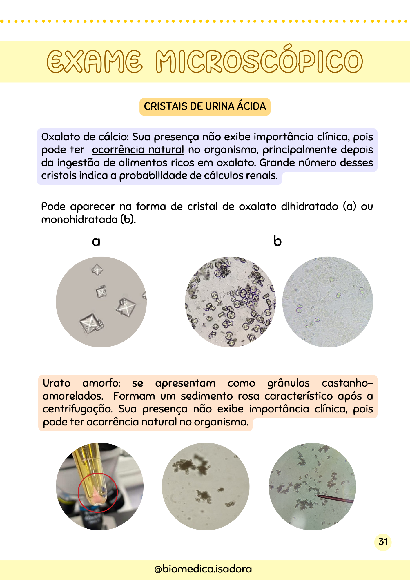 Resumo de Urinálise (3)